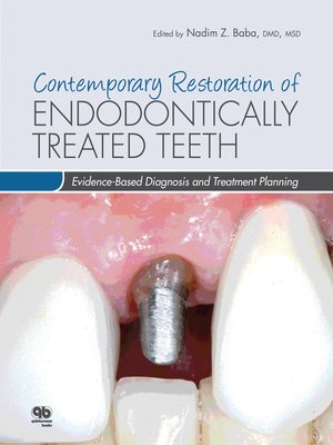 cover image of Contemporary Restoration of Endodontically Treated Teeth